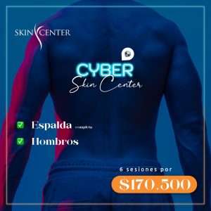 Depilación Láser Alex. - 6 sesiones de Espalda + Hombros