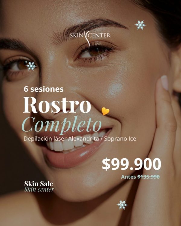 Depilación Láser Alexandrita - 6 ses Rostro Completo