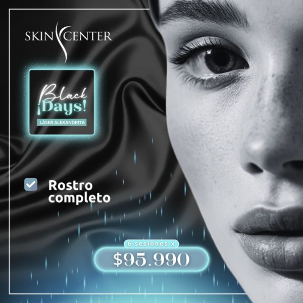 Depilación Láser Alexandrita - Rostro Completo