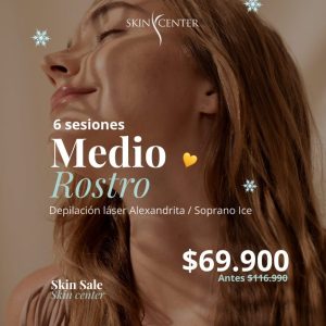 3 Depilación Alexandrita - 6 ses de Medio Rostro (3 zonas)