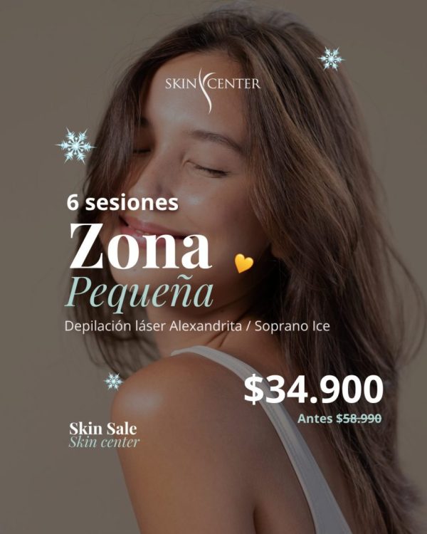 Depilación Láser Alexandrita - 6 ses Zona Pequeña a Elección