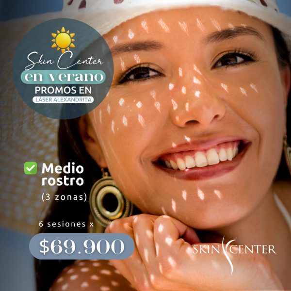 72 Depilación Alexandrita - 6 sesiones de Medio Rostro (3 zonas)