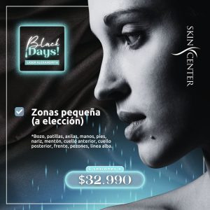 Depilación Láser Alexandrita - Zona Pequeña a Elección