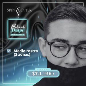 Depilación Alexandrita - 6 sesiones de Medio Rostro (3 zonas)