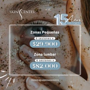 Depilación Láser Alexandrita - Zona Pequeña a Elección