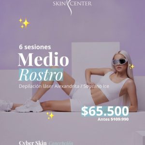 6 sesiones Medio Rostro (3 zonas) — Depilación láser Alexandrita / Soprano Ice · Cyber Skin Concepción · Skin Center