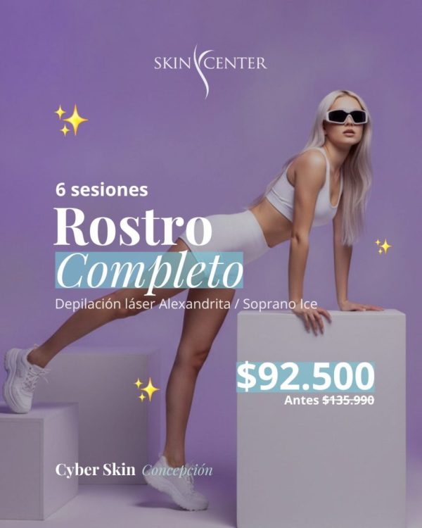 6 sesiones Rostro Completo — Depilación láser Alexandrita / Soprano Ice · Cyber Skin Concepción · Skin Center