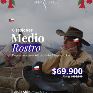 Fonda Skin - Depilación láser 6 sesiones Medio Rostro $69.900