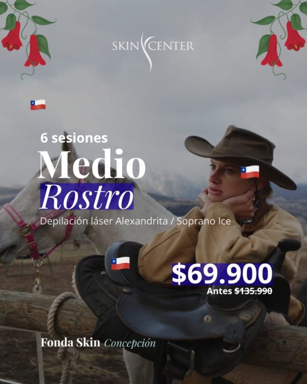 fonda-skin-2026-medio-rostro Fonda Skin - Depilación láser 6 sesiones Medio Rostro $69.900