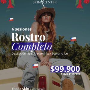 Fonda Skin - Depilación láser 6 sesiones Rostro Completo $99.900