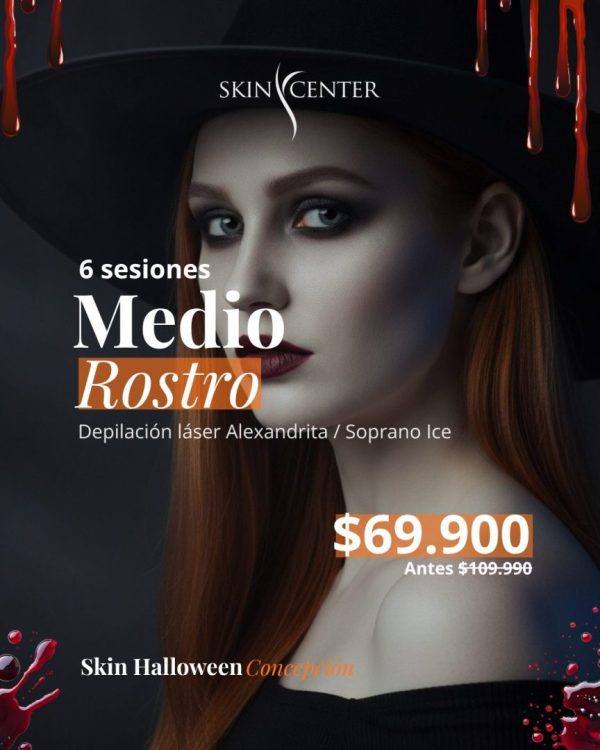 Skin Halloween Concepción - depilación láser medio rostro