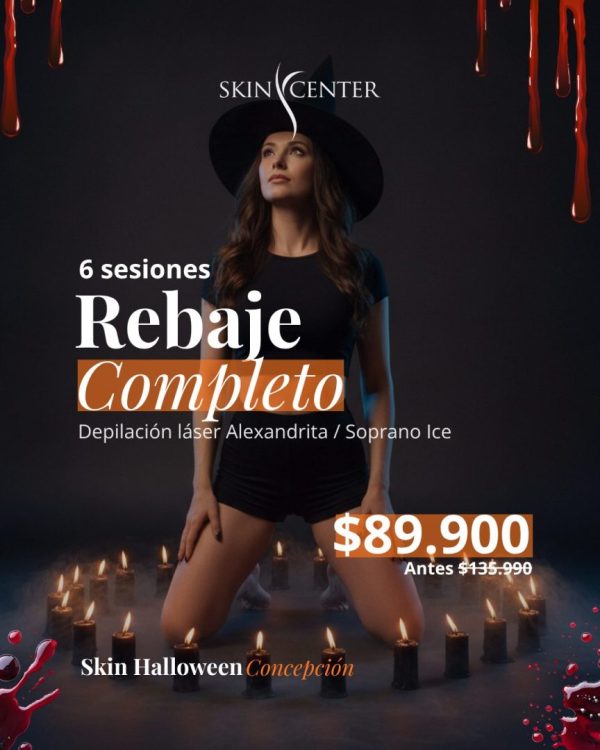 halloween-skin-2026-rebaje-completo Skin Halloween Concepción - depilación láser rebaje completo